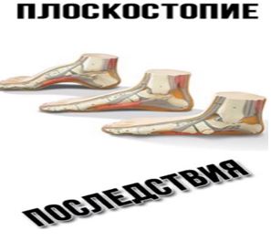 й1.JPG