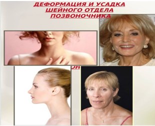 ос1.jpg