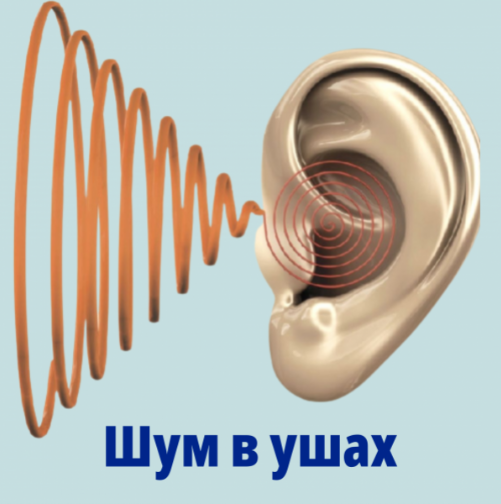 ухи.PNG